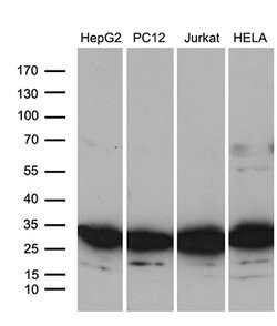 Invitrogen RPL10A Monoclonal Antibody (OTI2G9) 100 &mu;L; Unconjugated:Antibodies,