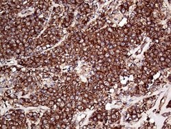 Invitrogen RPL10A Monoclonal Antibody (OTI4B2) 100 &mu;L; Unconjugated:Antibodies,