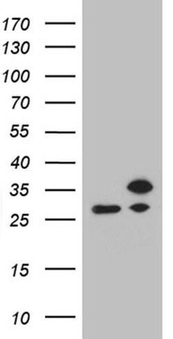 Invitrogen RPL10A Monoclonal Antibody (OTI4B2) 100 &mu;L; Unconjugated:Antibodies,