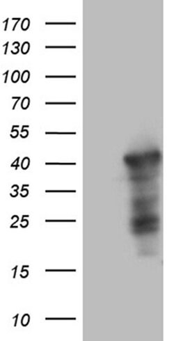 Invitrogen WDR92 Monoclonal Antibody (OTI1H8) 100 &mu;L | Buy Online | Invitrogen&trade; | Fisher Scientific
