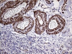Invitrogen TRMT12 Monoclonal Antibody (OTI1C9) 100 &mu;L; Unconjugated:Antibodies,
