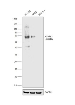 Invitrogen ACVRL1 Monoclonal Antibody (OTI5C2) 100 &mu;L; Unconjugated:Antibodies,