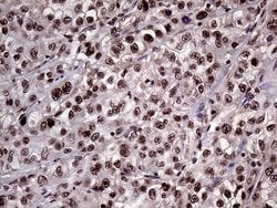 Invitrogen LHX4 Monoclonal Antibody (OTI1C7) 100 &mu;L; Unconjugated:Antibodies,