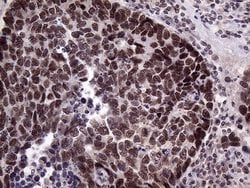 Invitrogen LHX4 Monoclonal Antibody (OTI1C7) 100 &mu;L; Unconjugated:Antibodies,