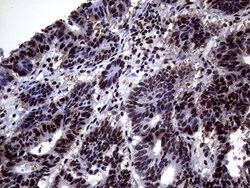 Invitrogen ANP32C Monoclonal Antibody (OTI10A10) 100 &mu;L; Unconjugated:Antibodies,
