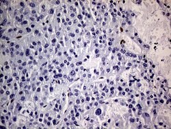 MEIS1 Monoclonal Antibody (OTI2A3), Invitrogen 100 &mu;L; Unconjugated:Antibodies,