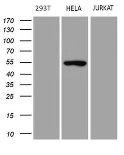 Invitrogen TRIP13 Monoclonal Antibody (OTI2F5) 100 &mu;L; Unconjugated:Antibodies,
