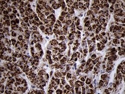 Invitrogen TIMM8A Monoclonal Antibody (OTI5C8) 100 &mu;L; Unconjugated:Antibodies,