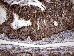 Invitrogen TIMM8A Monoclonal Antibody (OTI5C8) 100 &mu;L; Unconjugated:Antibodies,