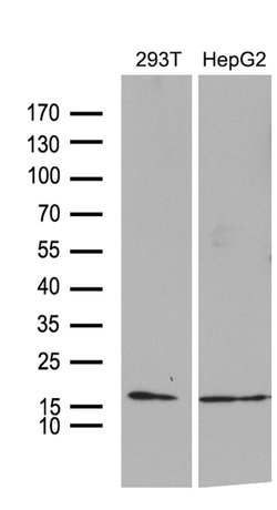 Invitrogen TIMM8A Monoclonal Antibody (OTI5C8) 100 &mu;L; Unconjugated:Antibodies,