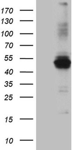 Invitrogen AGPAT9 Monoclonal Antibody (OTI1D11) 100 &mu;L; Unconjugated:Antibodies,