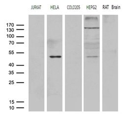 Invitrogen AGPAT9 Monoclonal Antibody (OTI1D11) 100 &mu;L; Unconjugated:Antibodies,