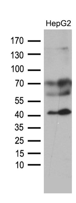 Invitrogen AGPAT9 Monoclonal Antibody (OTI3H3) 100 &mu;L; Unconjugated:Antibodies,
