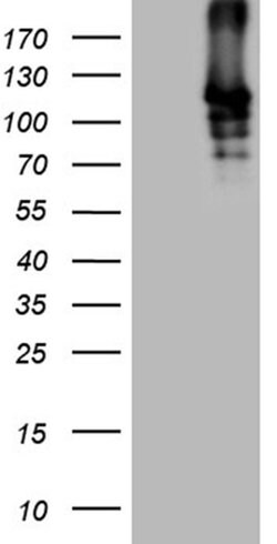 Invitrogen SIRT1 Monoclonal Antibody (OTI5B2) 100 &mu;L; Unconjugated:Antibodies,