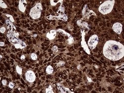Invitrogen TALDO1 Monoclonal Antibody (OTI2E4) 100 &mu;L; Unconjugated:Antibodies,
