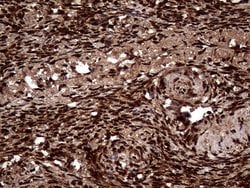 Invitrogen TALDO1 Monoclonal Antibody (OTI2E4) 100 &mu;L; Unconjugated:Antibodies,