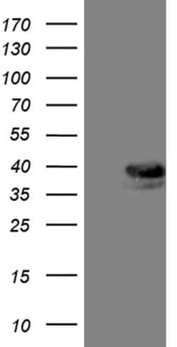 Invitrogen TALDO1 Monoclonal Antibody (OTI2E4) 100 &mu;L; Unconjugated:Antibodies,