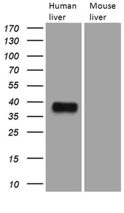 Invitrogen TALDO1 Monoclonal Antibody (OTI2E4) 100 &mu;L; Unconjugated:Antibodies,