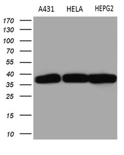 Invitrogen TALDO1 Monoclonal Antibody (OTI2E4) 100 &mu;L; Unconjugated:Antibodies,