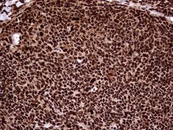 Invitrogen TALDO1 Monoclonal Antibody (OTI1E5) 100 &mu;L; Unconjugated:Antibodies,