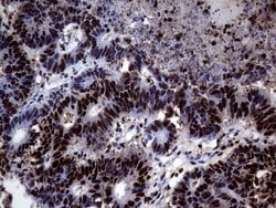 Invitrogen TALDO1 Monoclonal Antibody (OTI1E5) 100 &mu;L; Unconjugated:Antibodies,