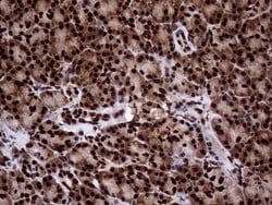 Invitrogen TALDO1 Monoclonal Antibody (OTI1E5) 100 &mu;L; Unconjugated:Antibodies,