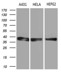 Invitrogen TALDO1 Monoclonal Antibody (OTI1E5) 100 &mu;L; Unconjugated:Antibodies,