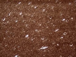 Invitrogen PRRT2 Monoclonal Antibody (OTI9H8) 100 &mu;L; Unconjugated:Antibodies,