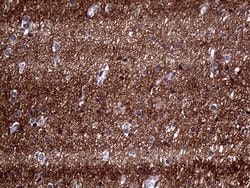 Invitrogen PRRT2 Monoclonal Antibody (OTI9H8) 100 &mu;L; Unconjugated:Antibodies,