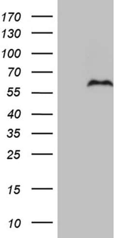 Invitrogen PRRT2 Monoclonal Antibody (OTI9H8) 100 &mu;L; Unconjugated:Antibodies,