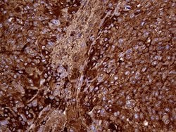 METTL7A Monoclonal Antibody (OTI4B10):Antibodies, Monoclonal