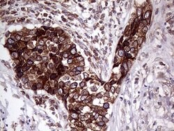 Invitrogen Lass2 Monoclonal Antibody (OTI3D9) 100 &mu;L; Unconjugated:Antibodies,