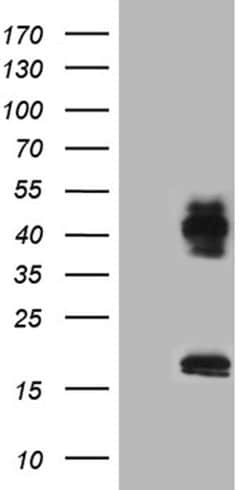 Invitrogen Lass2 Monoclonal Antibody (OTI3D9) 100 &mu;L; Unconjugated:Antibodies,