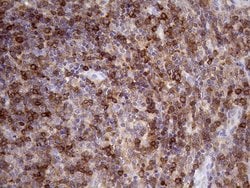 Invitrogen DGKZ Monoclonal Antibody (OTI1A6) 100 &mu;L; Unconjugated:Antibodies,