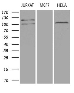 Invitrogen DGKZ Monoclonal Antibody (OTI1A6) 100 &mu;L; Unconjugated:Antibodies,