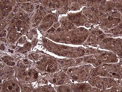 Invitrogen AMDHD1 Monoclonal Antibody (OTI5B5) 100 &mu;L; Unconjugated:Antibodies,