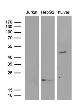 Invitrogen AMDHD1 Monoclonal Antibody (OTI5B5) 100 &mu;L; Unconjugated:Antibodies,
