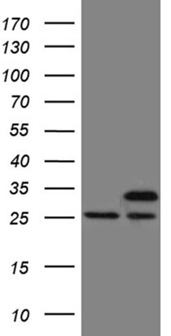 Invitrogen PCMT1 Monoclonal Antibody (OTI4A4) 100 &mu;L; Unconjugated:Antibodies,