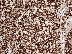 Invitrogen DDX19A Monoclonal Antibody (OTI3C12) 100 &mu;L; Unconjugated:Antibodies,