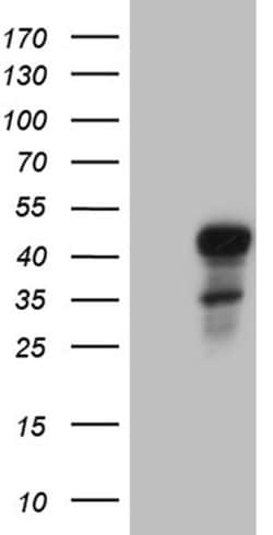 Invitrogen ELF3 Monoclonal Antibody (OTI6G6) 100 μL; Unconjugated:Antibodies,