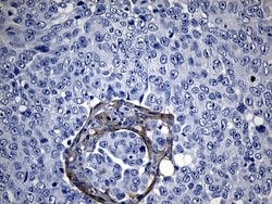 Invitrogen ROR2 Monoclonal Antibody (OTI4B10) 100 &mu;L; Unconjugated:Antibodies,