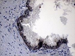 Invitrogen ROR2 Monoclonal Antibody (OTI4B10) 100 &mu;L; Unconjugated:Antibodies,