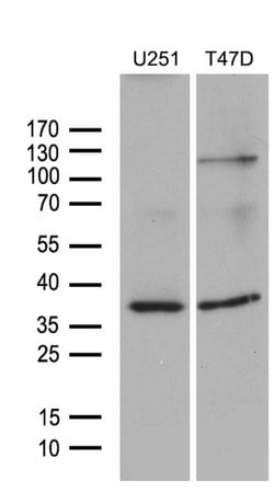 Invitrogen DIMT1 Monoclonal Antibody (OTI6E7) 100 &mu;L; Unconjugated:Antibodies,