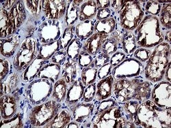 Invitrogen CHP1 Monoclonal Antibody (OTI1D11) 100 &mu;L; Unconjugated:Antibodies,