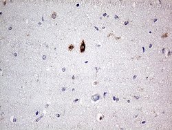 Invitrogen SLC22A17 Monoclonal Antibody (OTI2D6) 100 &mu;L | Buy Online | Invitrogen&trade; | Fisher Scientific