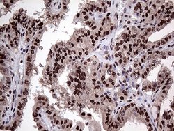 Invitrogen PPP4C Monoclonal Antibody (OTI2E4) 100 &mu;L; Unconjugated:Antibodies,