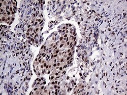 Invitrogen PPP4C Monoclonal Antibody (OTI2E4) 100 &mu;L; Unconjugated:Antibodies,