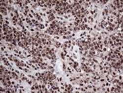 Invitrogen PPP4C Monoclonal Antibody (OTI2E4) 100 &mu;L; Unconjugated:Antibodies,