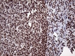 Invitrogen PPP4C Monoclonal Antibody (OTI2E4) 100 &mu;L; Unconjugated:Antibodies,