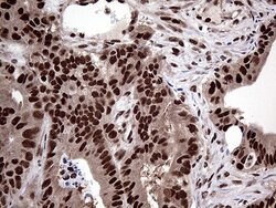 Invitrogen PPP4C Monoclonal Antibody (OTI2E4) 100 &mu;L; Unconjugated:Antibodies,